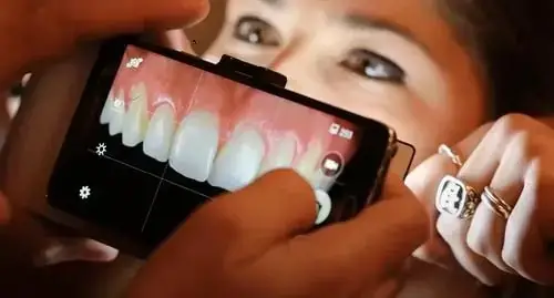 5 Best Phones for Dental Photography in 2022 – Expert Guide